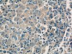 CFP Antibody in Immunohistochemistry (Paraffin) (IHC (P))