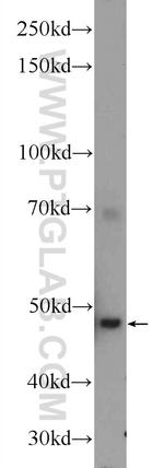 CFP Antibody in Western Blot (WB)