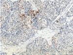 RSPO3 Antibody in Immunohistochemistry (Paraffin) (IHC (P))