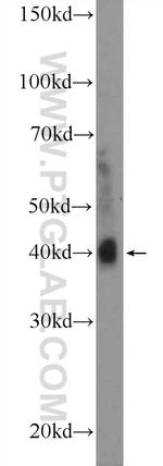 RSPO3 Antibody in Western Blot (WB)