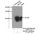 MGMT Antibody in Immunoprecipitation (IP)