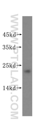 MGMT Antibody in Western Blot (WB)