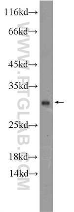RNASE11 Antibody in Western Blot (WB)