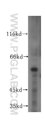 OSBPL2 Antibody in Western Blot (WB)