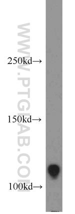 Rb Antibody in Western Blot (WB)