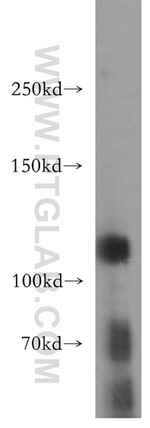 Rb Antibody in Western Blot (WB)