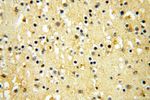 GPD2 Antibody in Immunohistochemistry (Paraffin) (IHC (P))