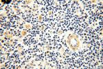 GPD2 Antibody in Immunohistochemistry (Paraffin) (IHC (P))