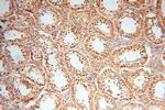 GPD2 Antibody in Immunohistochemistry (Paraffin) (IHC (P))