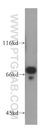 GPD2 Antibody in Western Blot (WB)