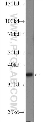 RBM11 Antibody in Western Blot (WB)