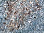 TLR2 Antibody in Immunohistochemistry (Paraffin) (IHC (P))