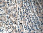 C6 Antibody in Immunohistochemistry (Paraffin) (IHC (P))