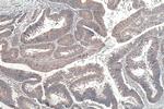 NSUN6 Antibody in Immunohistochemistry (Paraffin) (IHC (P))