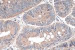 NSUN6 Antibody in Immunohistochemistry (Paraffin) (IHC (P))