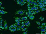 ATPB Antibody in Immunocytochemistry (ICC/IF)