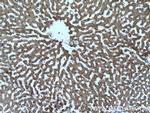 ATPB Antibody in Immunohistochemistry (Paraffin) (IHC (P))