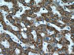 ATPB Antibody in Immunohistochemistry (Paraffin) (IHC (P))