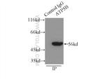 ATPB Antibody in Immunoprecipitation (IP)