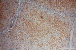 ATPB Antibody in Immunohistochemistry (Paraffin) (IHC (P))