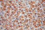 ATPB Antibody in Immunohistochemistry (Paraffin) (IHC (P))