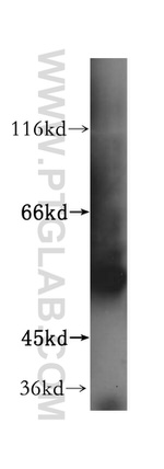 ATPB Antibody in Western Blot (WB)