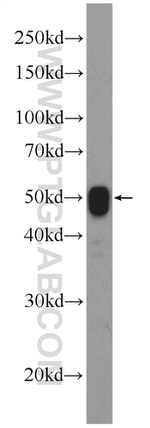 ATPB Antibody in Western Blot (WB)