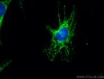 ATPB Antibody in Immunocytochemistry (ICC/IF)