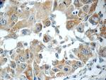 RB1CC1 Antibody in Immunohistochemistry (Paraffin) (IHC (P))