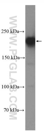 RB1CC1 Antibody in Western Blot (WB)