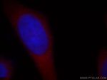 RB1CC1 Antibody in Immunocytochemistry (ICC/IF)