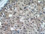 RB1CC1 Antibody in Immunohistochemistry (Paraffin) (IHC (P))