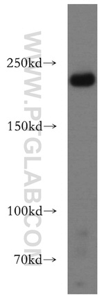 RB1CC1 Antibody in Western Blot (WB)