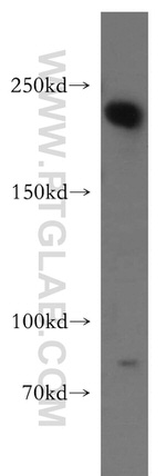 RB1CC1 Antibody in Western Blot (WB)