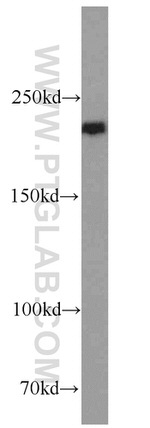 RB1CC1 Antibody in Western Blot (WB)