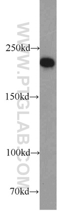 RB1CC1 Antibody in Western Blot (WB)