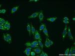 Collagen Type VIII Antibody in Immunocytochemistry (ICC/IF)