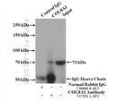 Collagen Type VIII Antibody in Immunoprecipitation (IP)