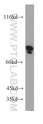 Collagen Type VIII Antibody in Western Blot (WB)