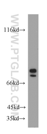 Collagen Type VIII Antibody in Western Blot (WB)