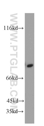 Collagen Type VIII Antibody in Western Blot (WB)