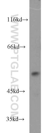 DUS1L Antibody in Western Blot (WB)