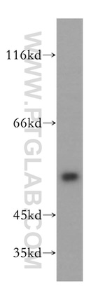 DUS1L Antibody in Western Blot (WB)