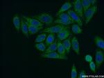 SARS2 Antibody in Immunocytochemistry (ICC/IF)