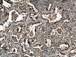 SARS2 Antibody in Immunohistochemistry (Paraffin) (IHC (P))