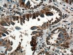 SARS2 Antibody in Immunohistochemistry (Paraffin) (IHC (P))