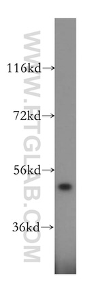 SARS2 Antibody in Western Blot (WB)