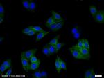 HLA class I (HLA-B) Antibody in Immunocytochemistry (ICC/IF)