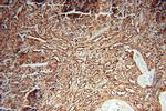 HLA class I (HLA-B) Antibody in Immunohistochemistry (Paraffin) (IHC (P))