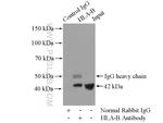 HLA class I (HLA-B) Antibody in Immunoprecipitation (IP)